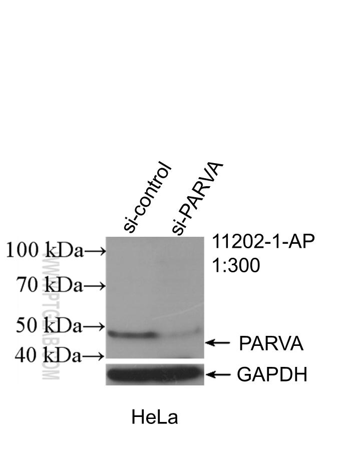 WB analysis of HeLa using 11202-1-AP