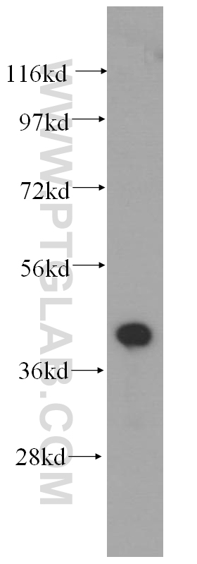 WB analysis of human liver using 11202-1-AP