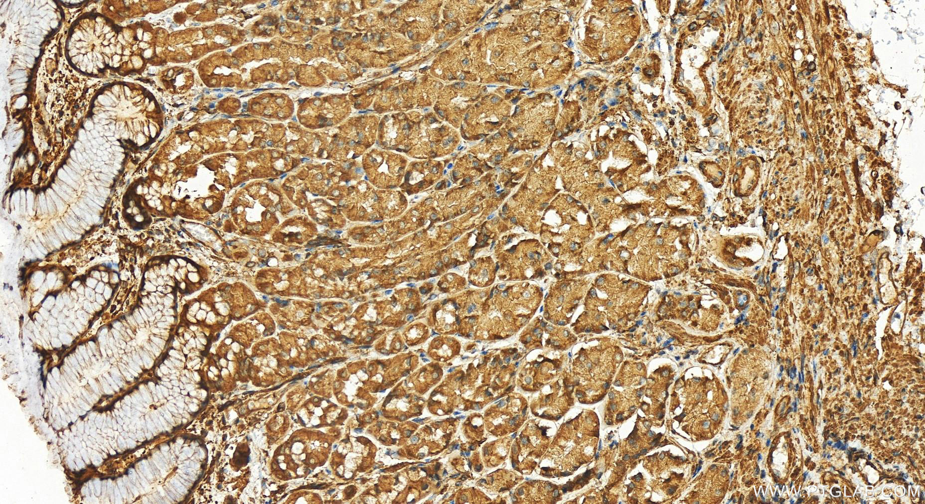 IHC staining of human stomach using 14463-1-AP