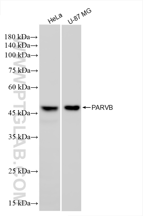 WB analysis using 85711-1-RR (same clone as 85711-1-PBS)