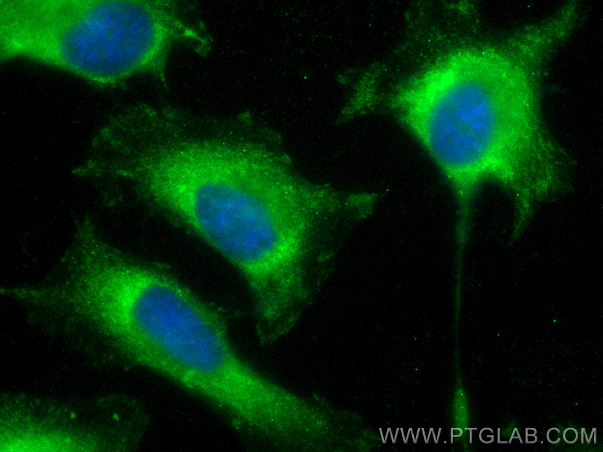 IF Staining of HeLa using CL488-14463