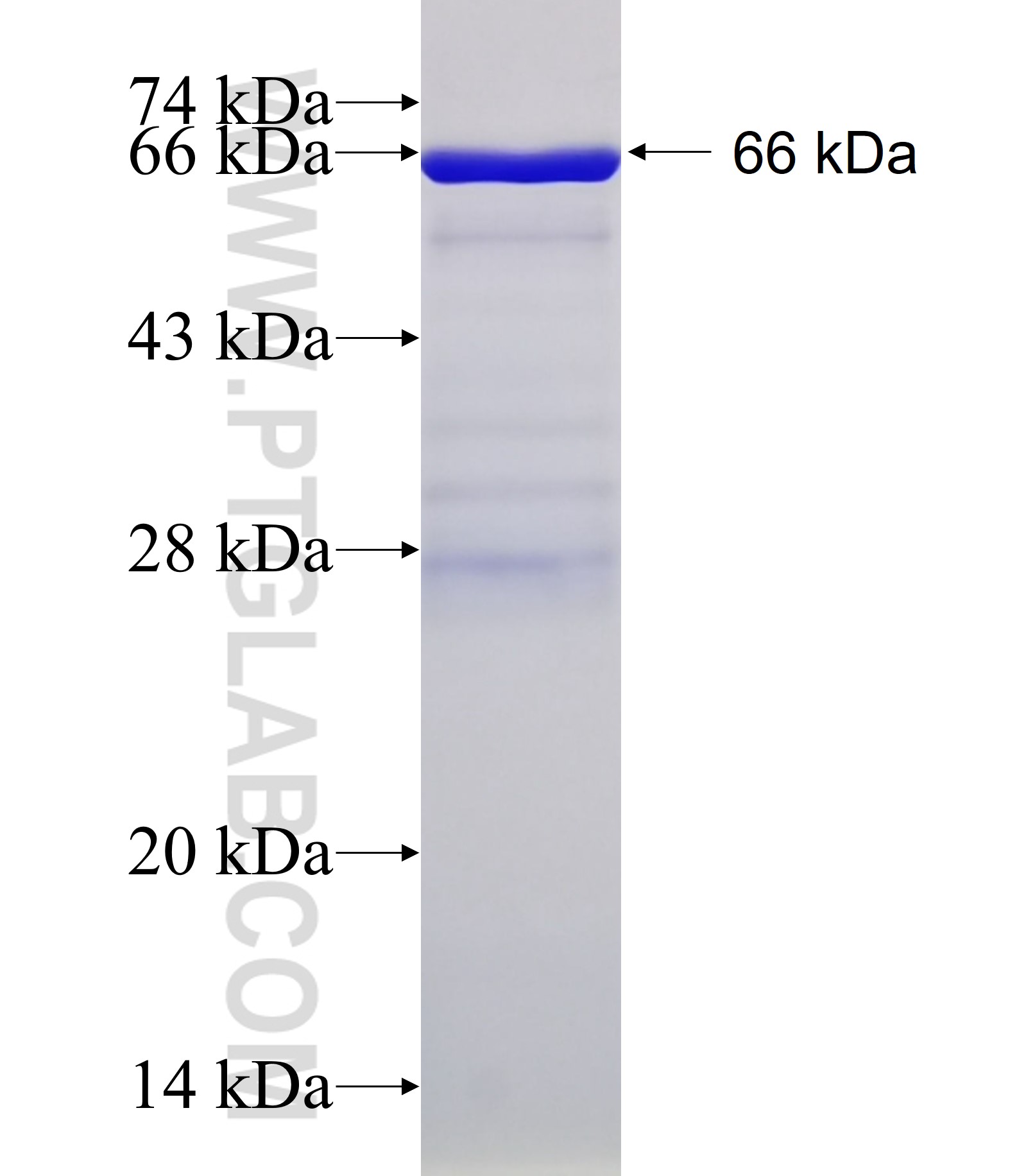 PARVB fusion protein Ag5760 SDS-PAGE