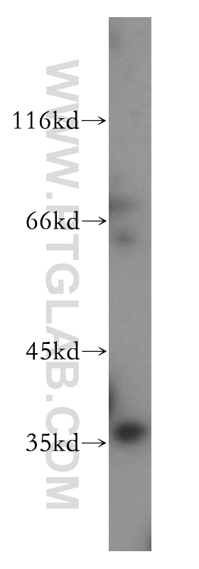 WB analysis of HL-60 using 13284-1-AP