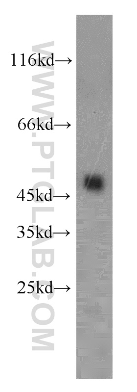 WB analysis of mouse pancreas using 12600-1-AP