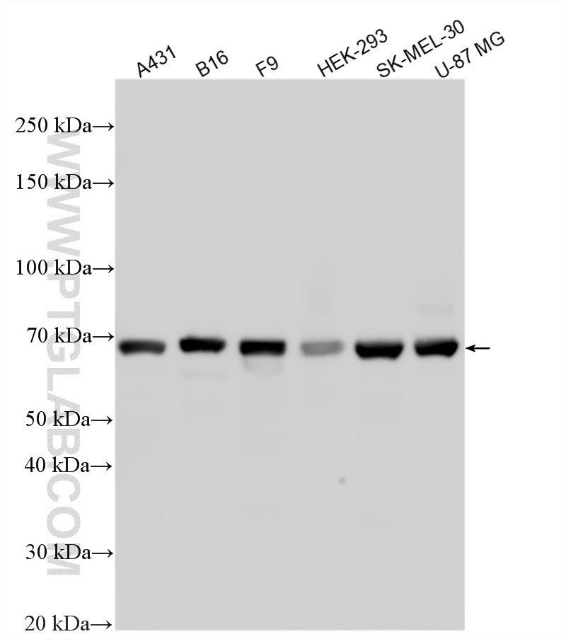 WB analysis using 21386-1-AP