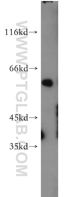 WB analysis of mouse skin using 21386-1-AP