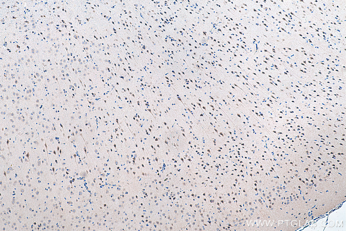 IHC staining of rat brain using 51036-2-AP