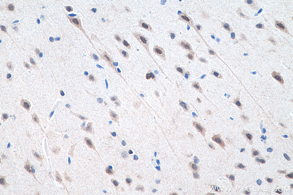 IHC staining of rat brain using 51036-2-AP