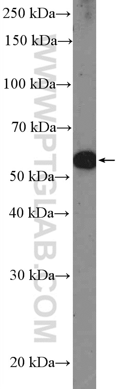 WB analysis of mouse skin using 51036-2-AP