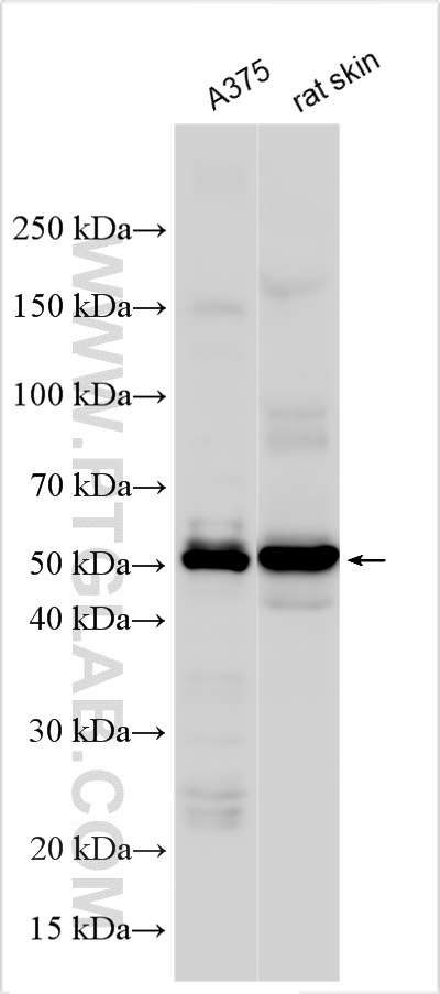 WB analysis using 51036-2-AP