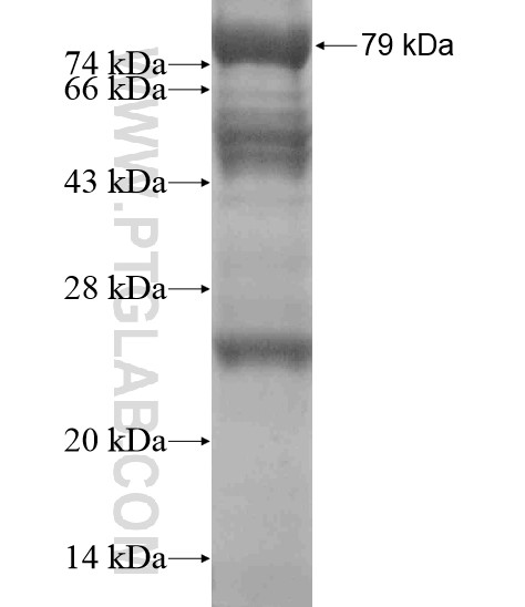 PAX3 fusion protein Ag19009 SDS-PAGE PAX3 fusion protein Ag19009 SDS-PAGE