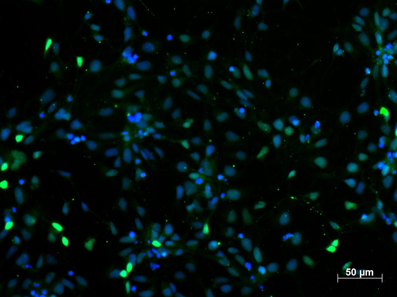 IF Staining of iPS cells using 12323-1-AP