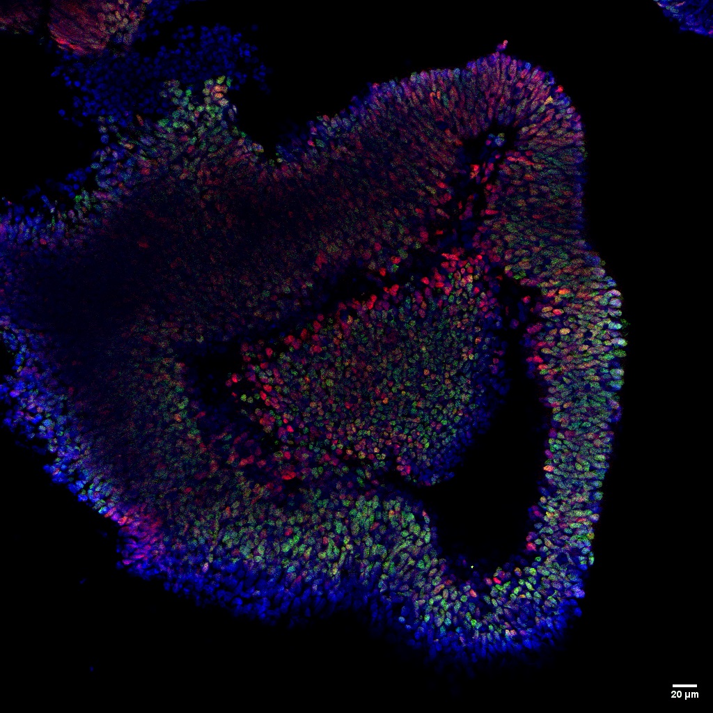 IF Staining of Retinal organoids using 12323-1-AP