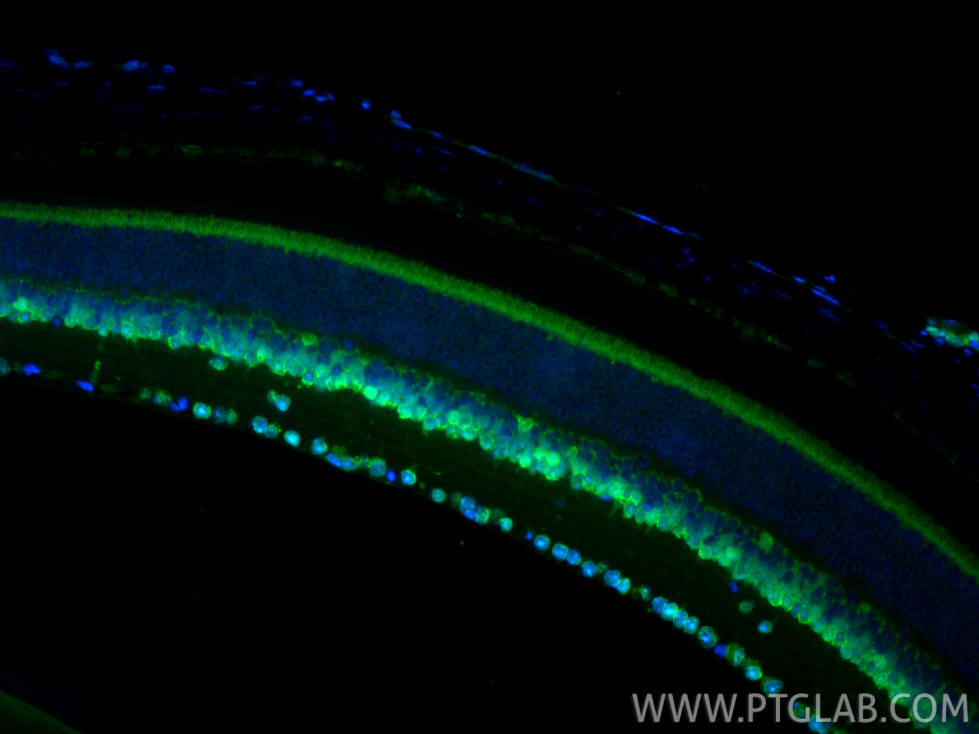IF Staining of mouse eye using 12323-1-AP