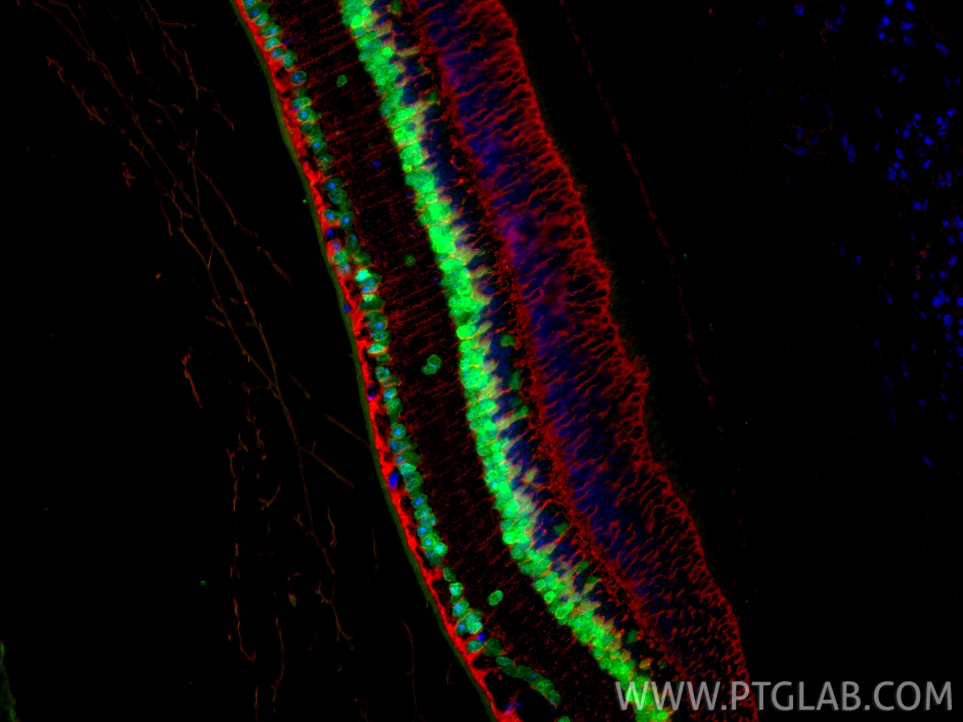 IF Staining of mouse eye using 12323-1-AP IF Staining of mouse eye using 12323-1-AP