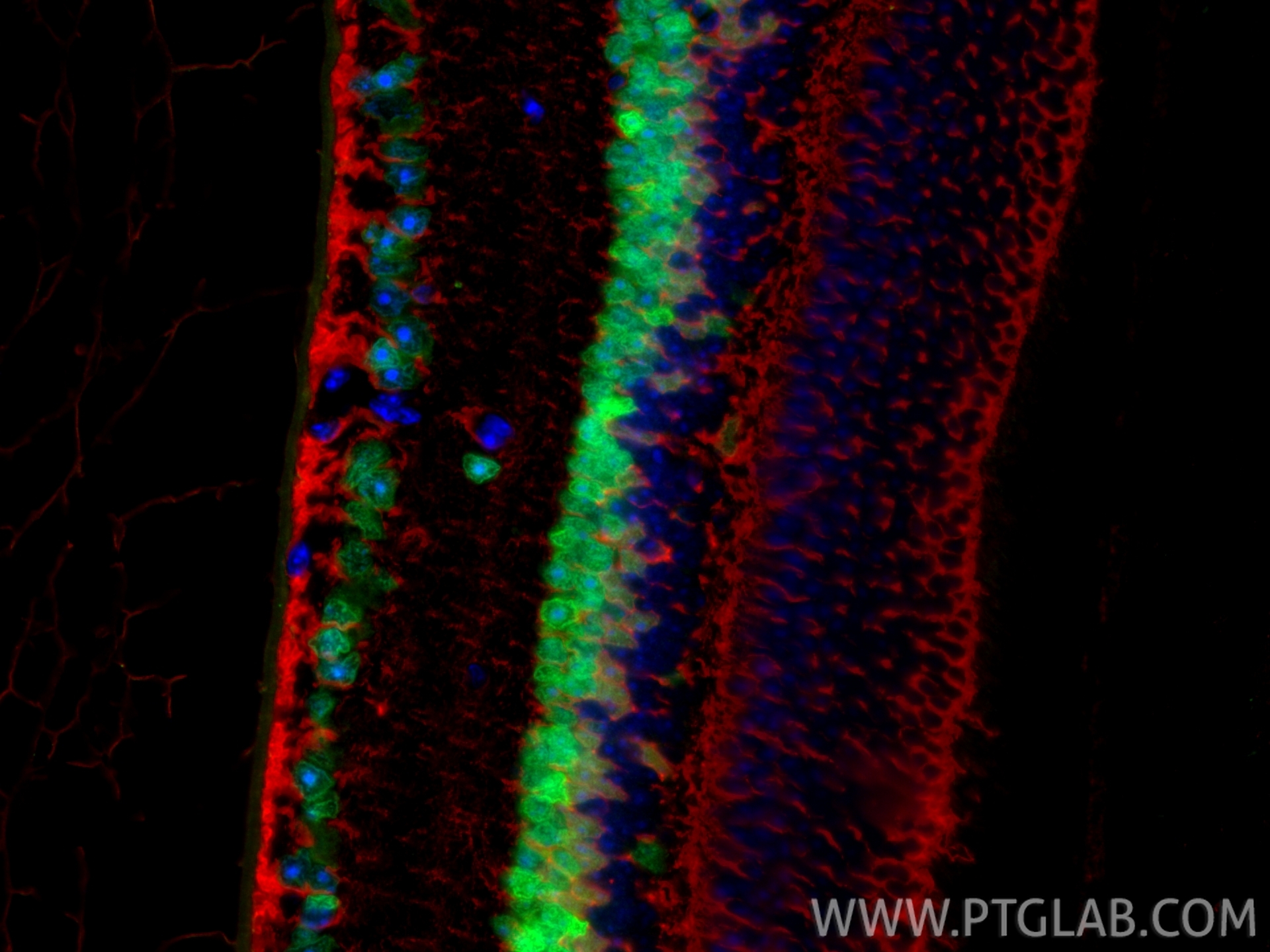 IF Staining of mouse eye using 12323-1-AP IF Staining of mouse eye using 12323-1-AP