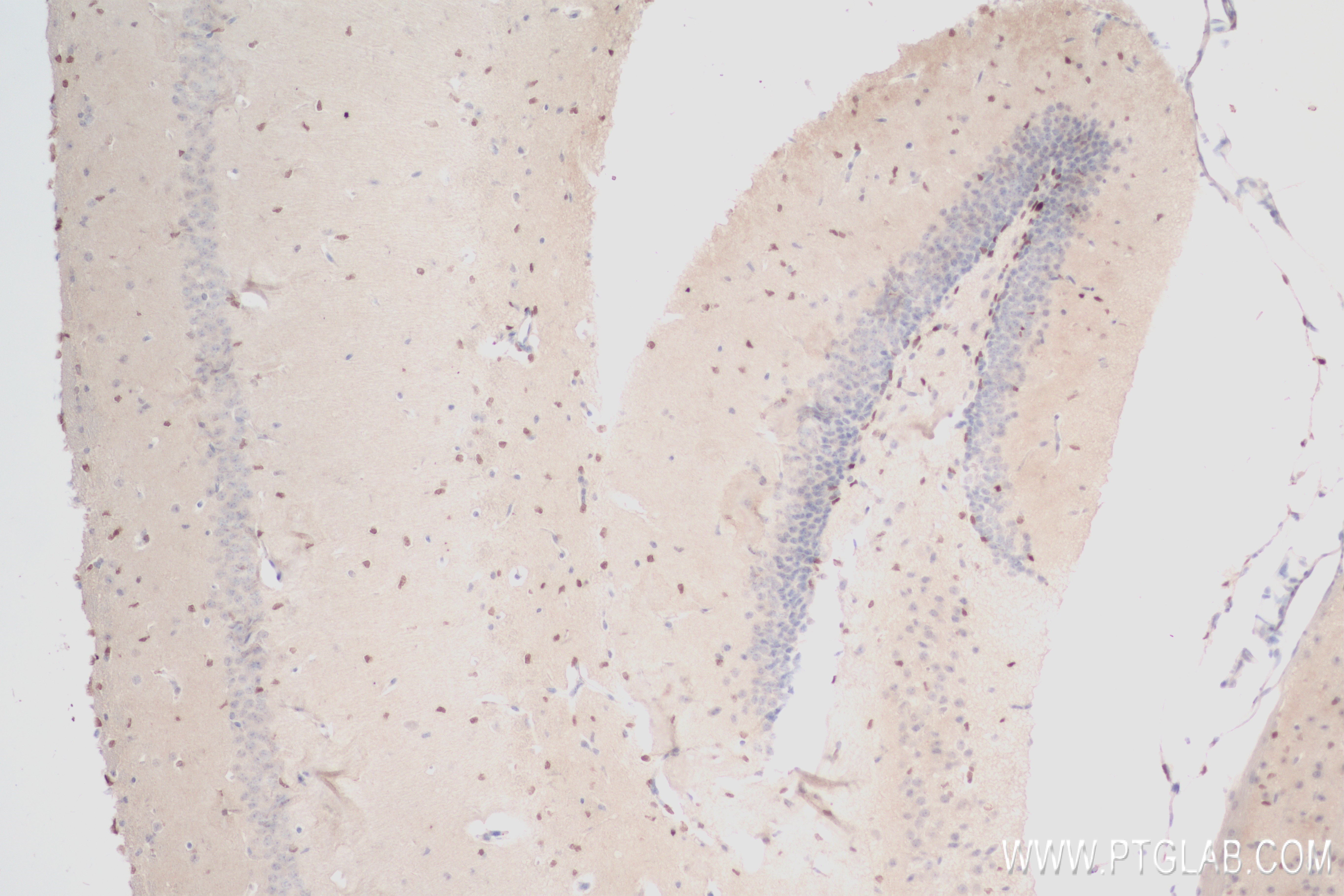 IHC staining of mouse brain using 84345-5-RR