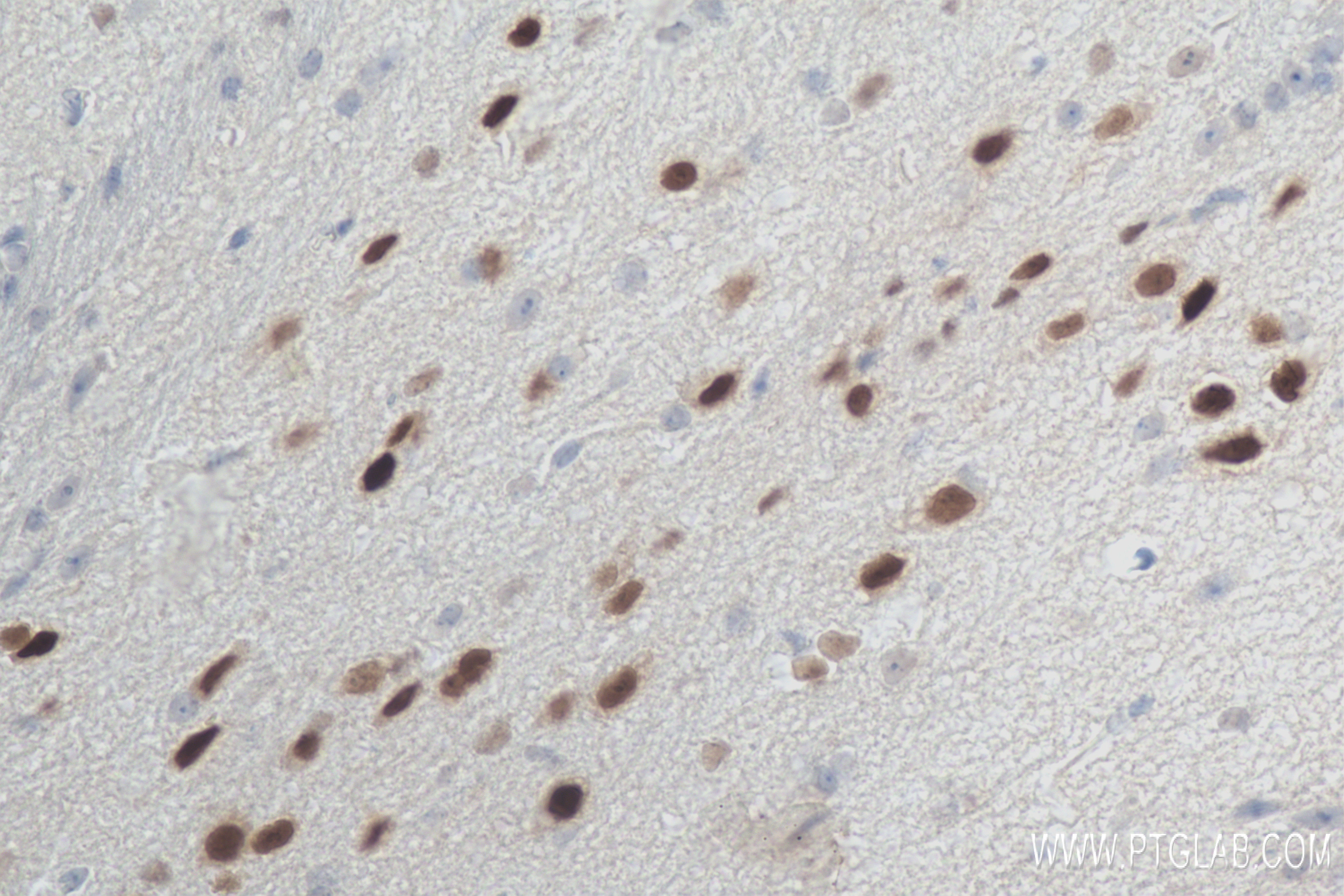 IHC staining of mouse brain using 84345-5-RR