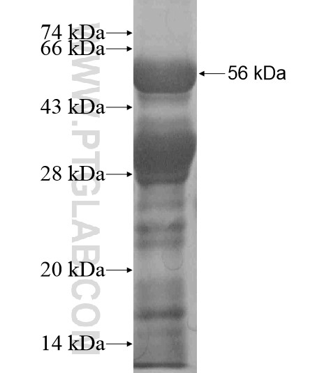 PAX6 fusion protein Ag19014 SDS-PAGE PAX6 fusion protein Ag19014 SDS-PAGE