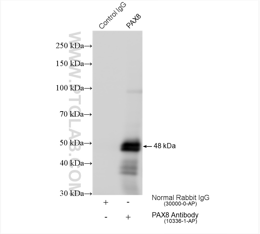 IP experiment of SKOV-3 using 10336-1-AP