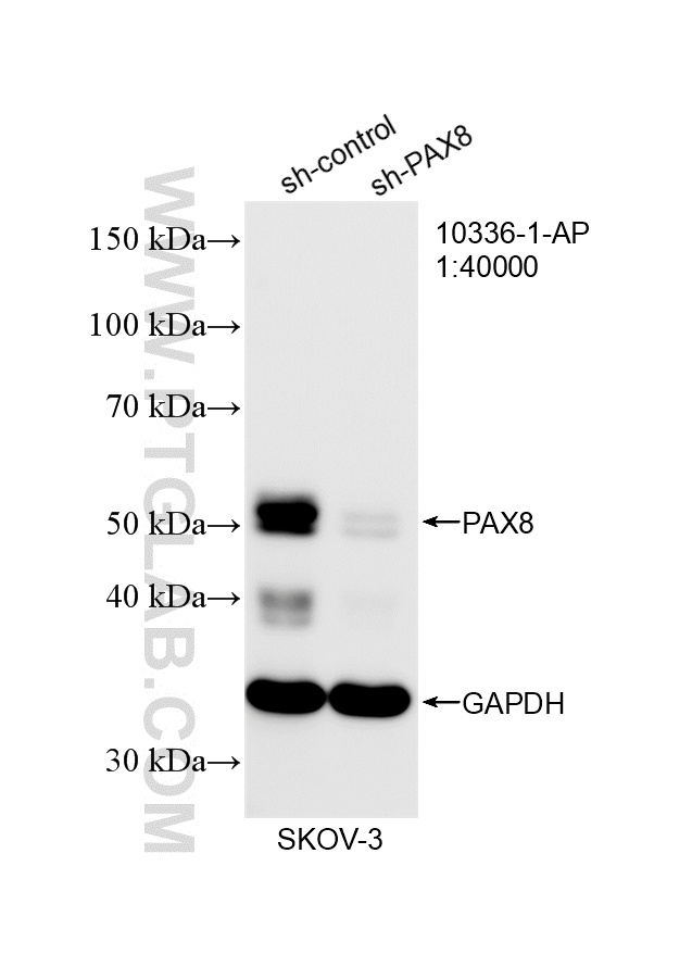 WB analysis of SKOV-3 using 10336-1-AP