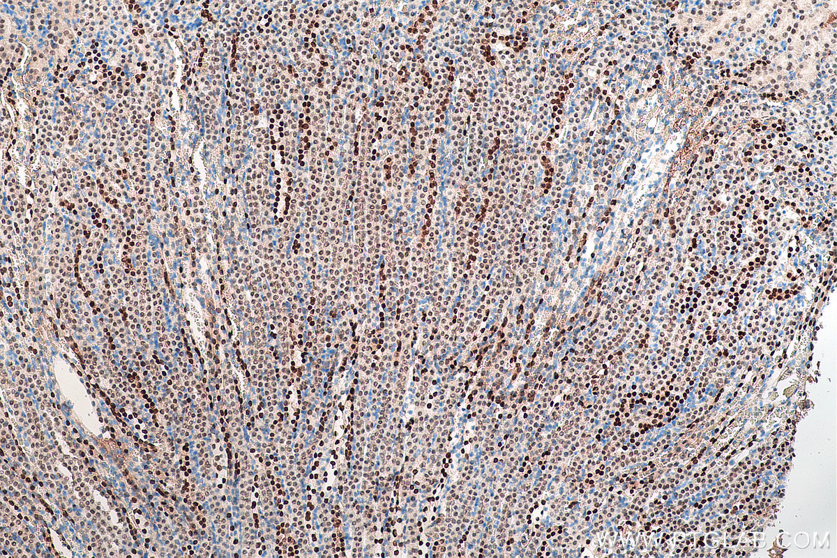 IHC staining of mouse kidney using 60145-4-Ig