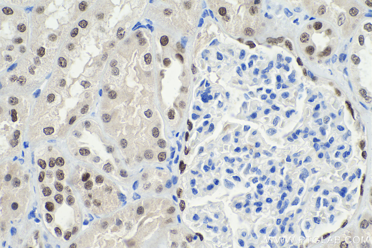 IHC staining of human kidney using 60145-4-Ig