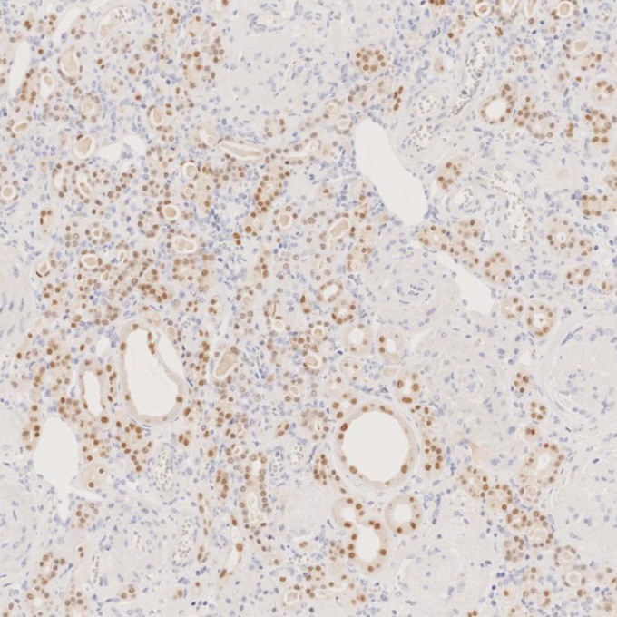 IHC staining of human kidney using 60145-4-Ig