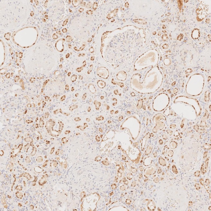 IHC staining of human kidney using 60145-4-Ig