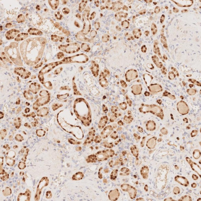 IHC staining of human kidney using 80756-1-RR IHC staining of human kidney using 80756-1-RR