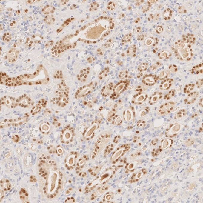 IHC staining of human kidney using 80756-1-RR IHC staining of human kidney using 80756-1-RR