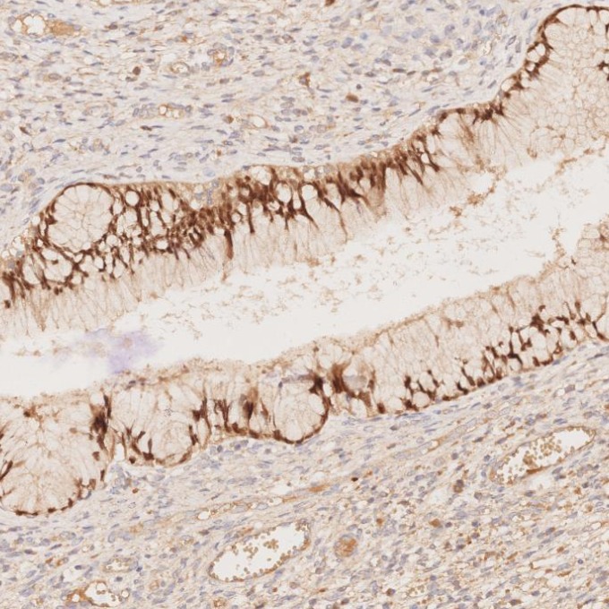 IHC staining of human cervix using 80756-1-RR IHC staining of human cervix using 80756-1-RR