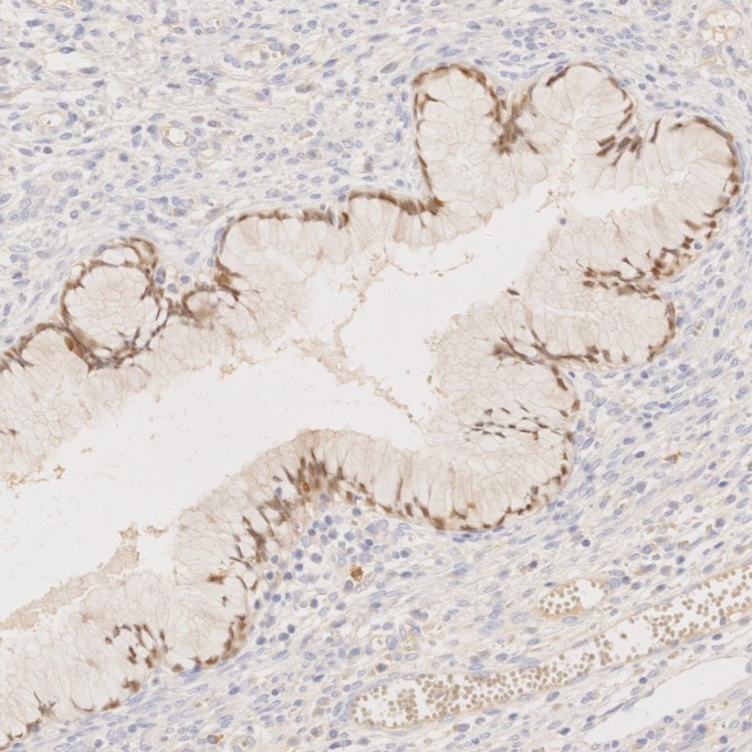IHC staining of human cervix using 80756-1-RR IHC staining of human cervix using 80756-1-RR