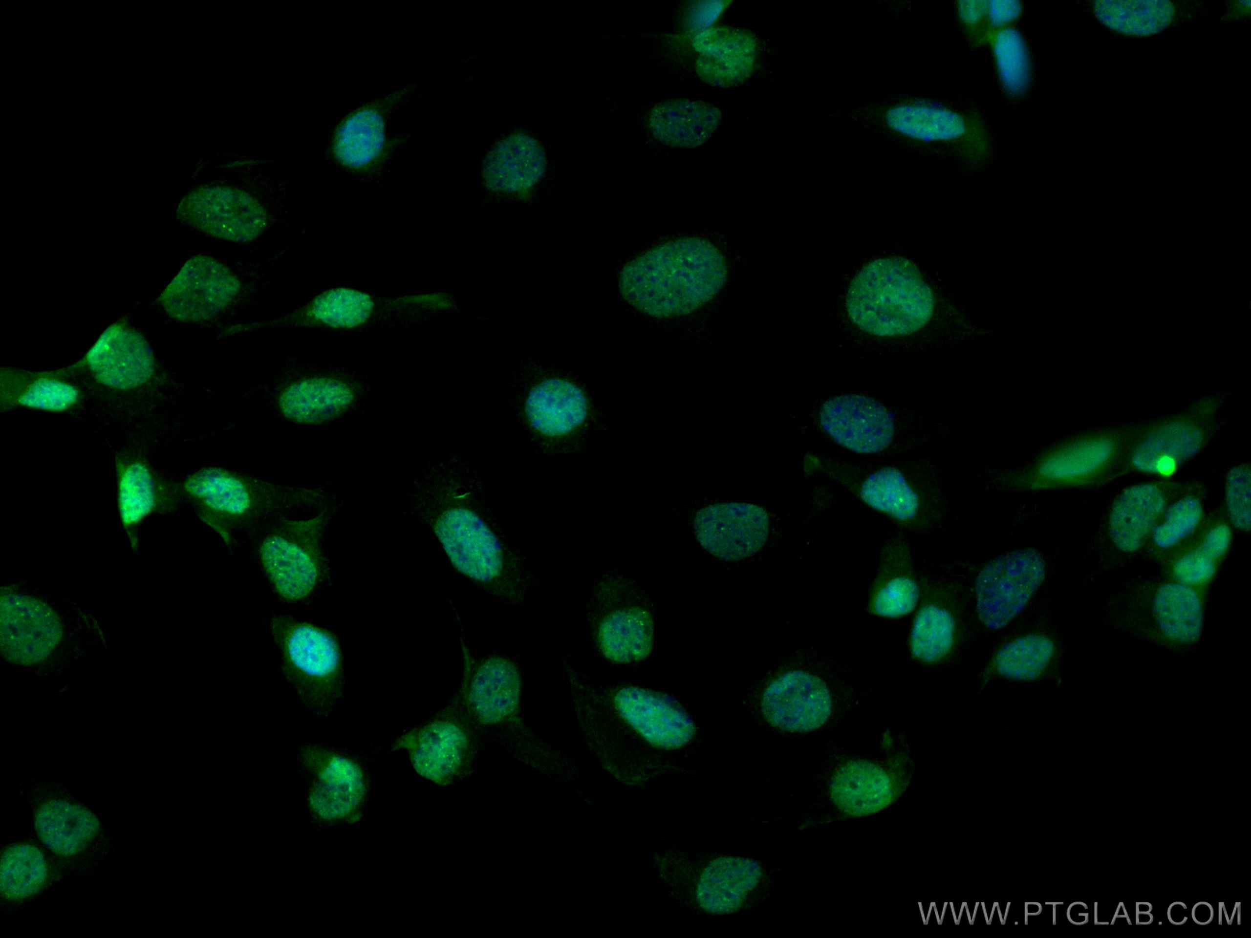 IF Staining of SKOV-3 using CL488-80756