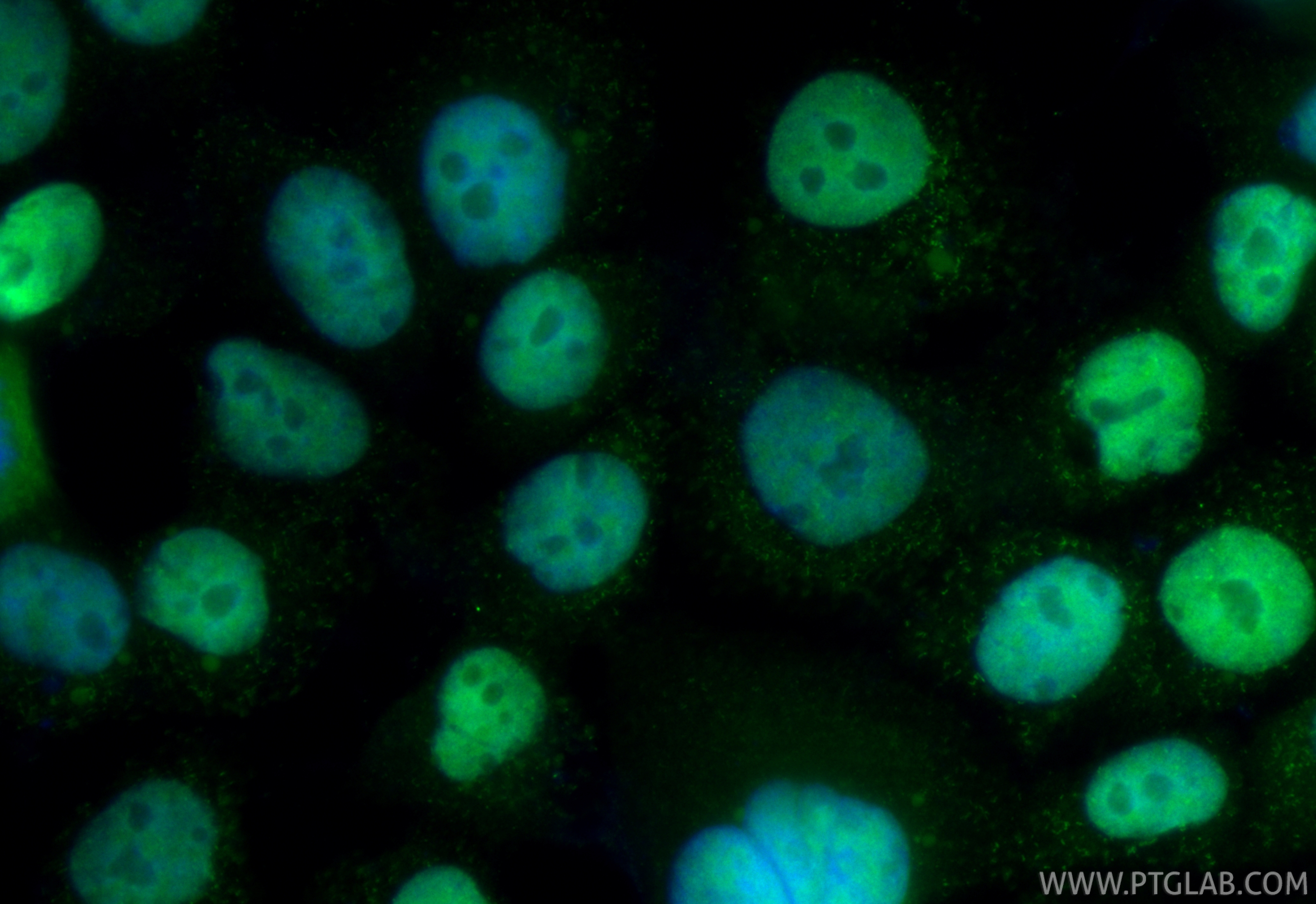 IF Staining of OVCAR-3 using CL488-81032 IF Staining of OVCAR-3 using CL488-81032