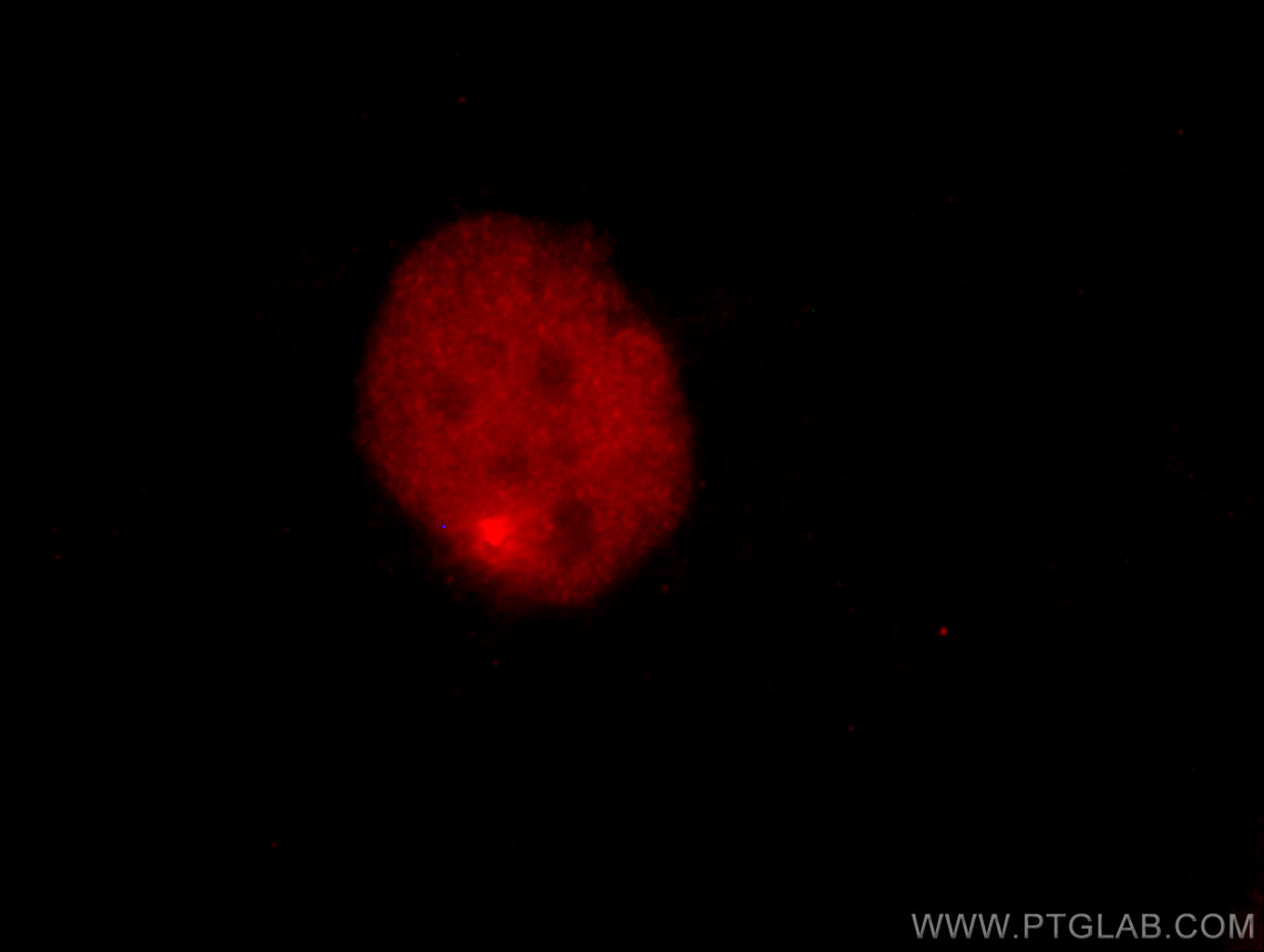 IF Staining of SKOV-3 using CL594-60145