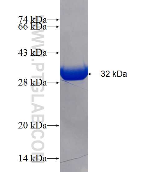 PAX8 fusion protein Ag13659 SDS-PAGE
