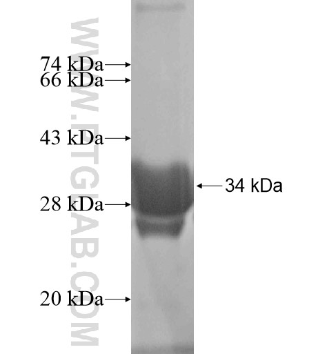 PAX8 fusion protein Ag16019 SDS-PAGE