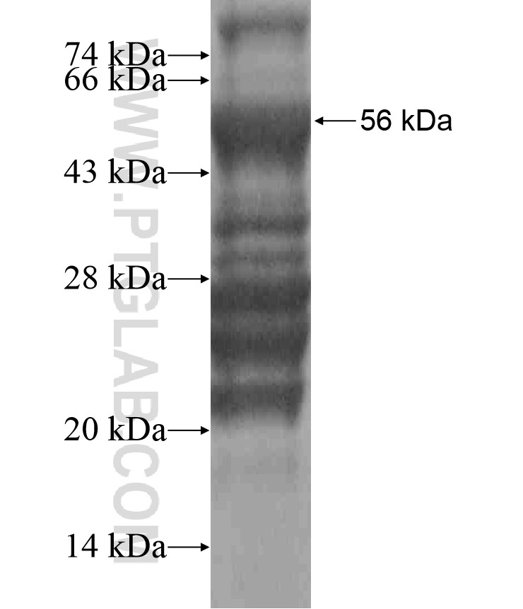 PAX8 fusion protein Ag17759 SDS-PAGE