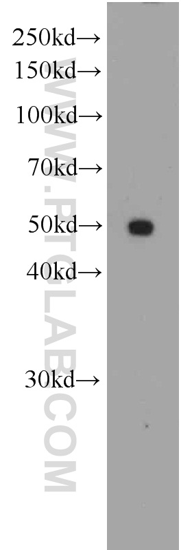 WB analysis of SKOV-3 using 66073-1-Ig