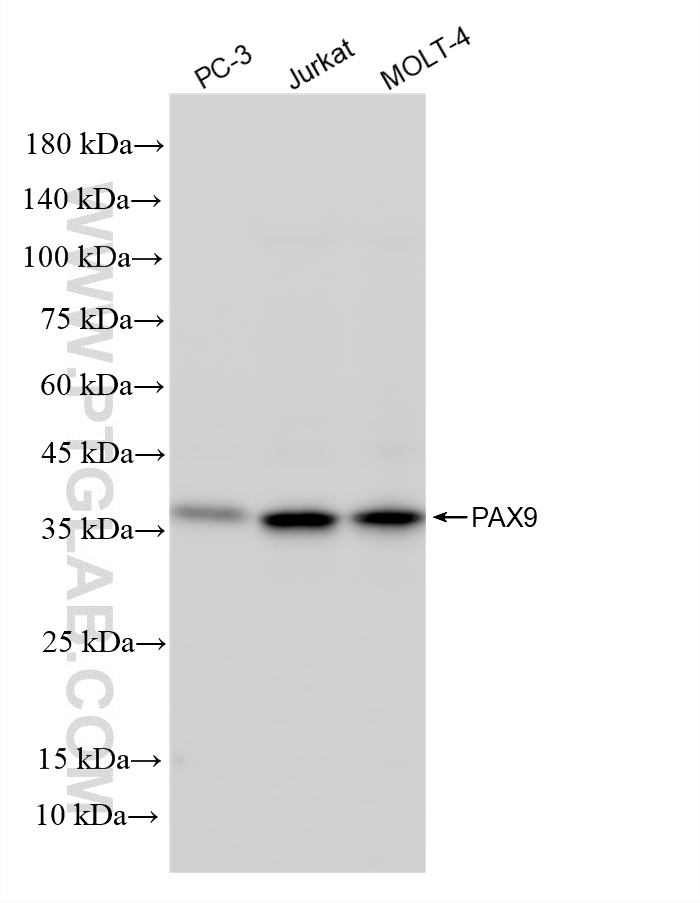 WB analysis using 87678-3-RR (same clone as 87678-3-PBS) WB analysis using 87678-3-RR (same clone as 87678-3-PBS)