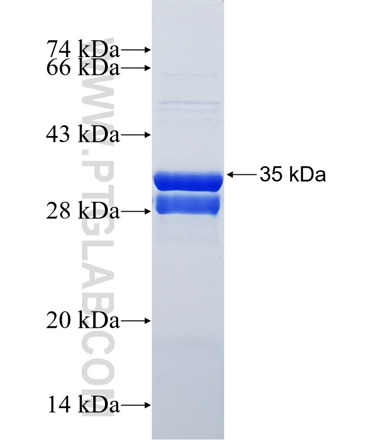 PAX9 fusion protein Ag25381 SDS-PAGE PAX9 fusion protein Ag25381 SDS-PAGE