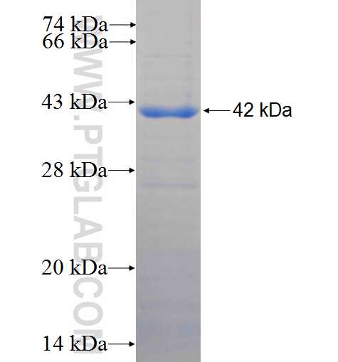 PAXIP1 fusion protein Ag4567 SDS-PAGE
