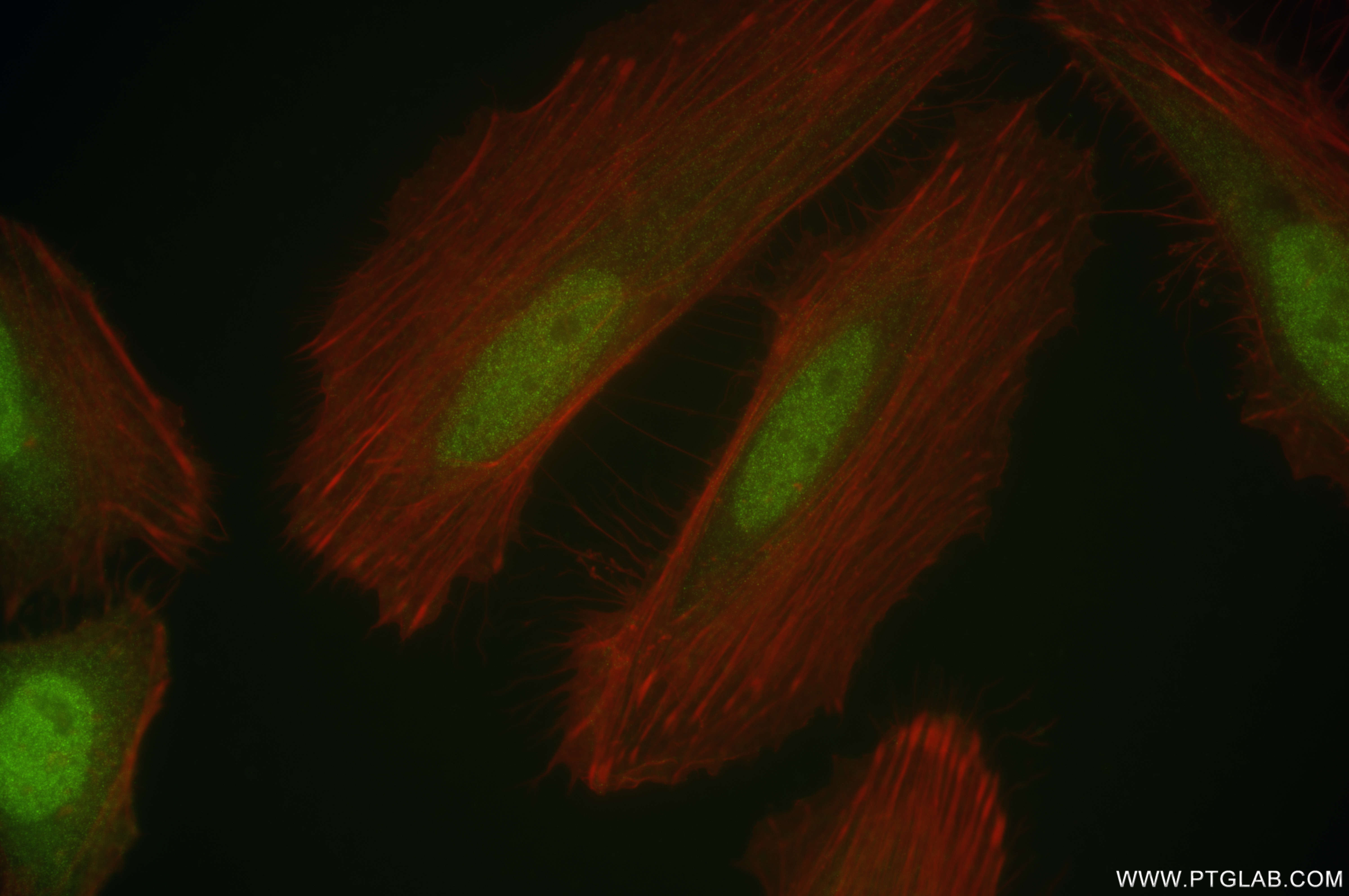 IF Staining of HeLa using 84970-1-RR (same clone as 84970-1-PBS)