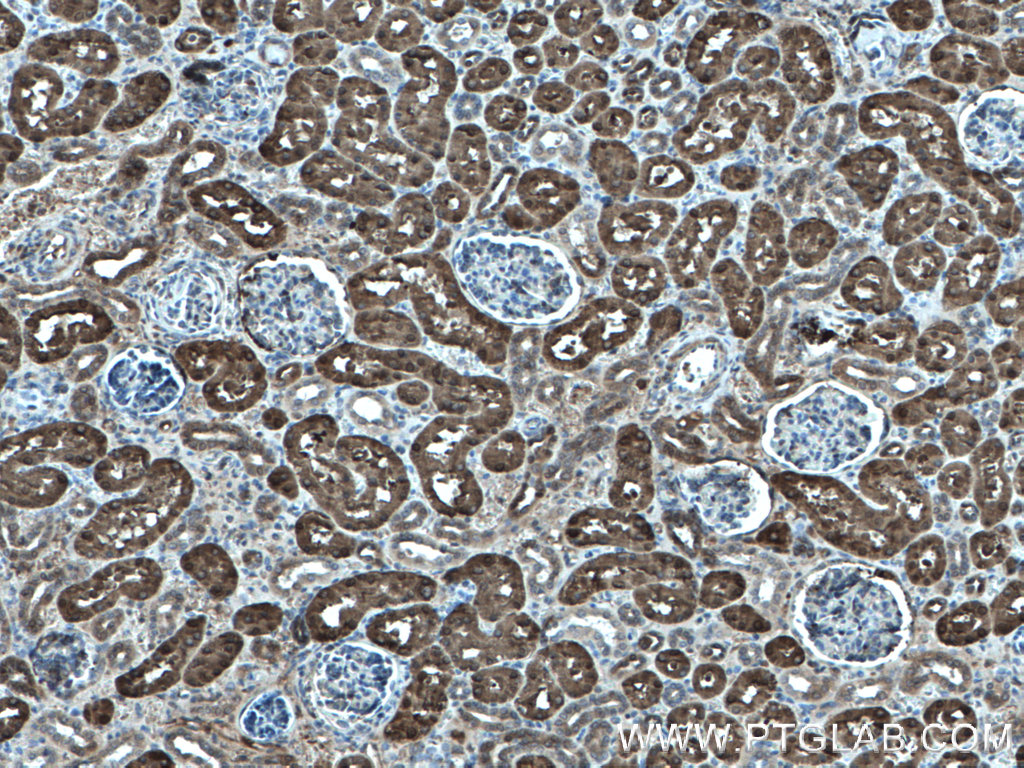 IHC staining of human kidney using 27891-1-AP