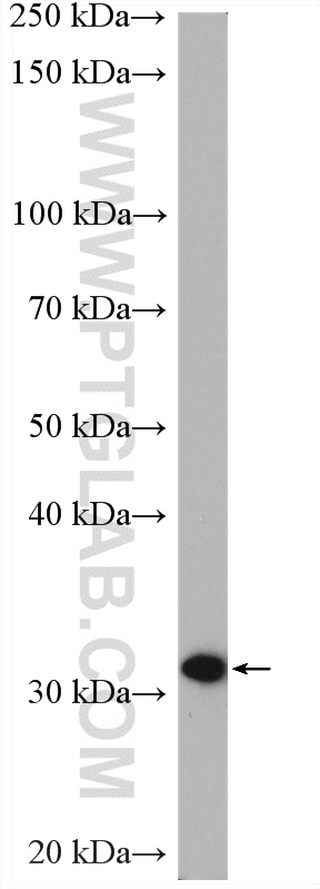 WB analysis of mouse kidney using 27891-1-AP