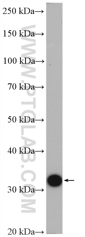 WB analysis of mouse liver using 27891-1-AP