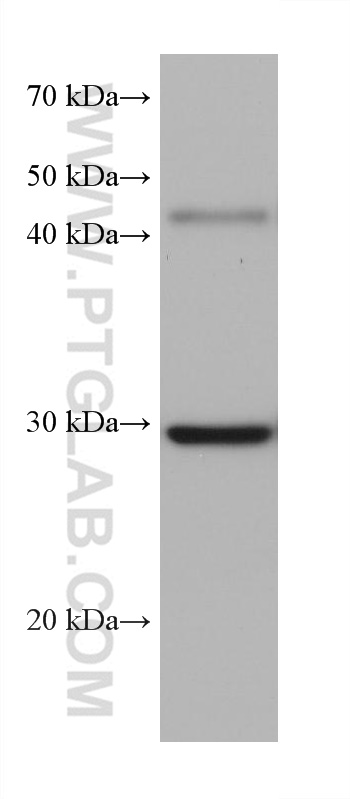 WB analysis of pig kidney using 68317-1-Ig