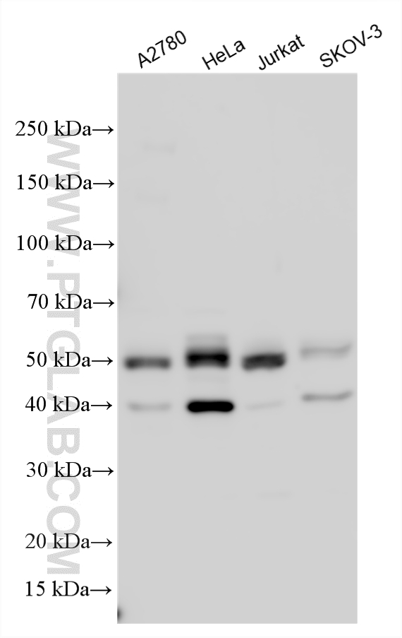 Various lysates were subjected to SDS PAGE followed by western blot with 18204-1-AP (PBX1 antibody) at dilution of 1:3000 incubated at room temperature for 1.5 hours. WB analysis using 18204-1-AP