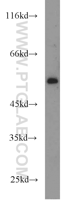 PBX1 Polyclonal antibody
